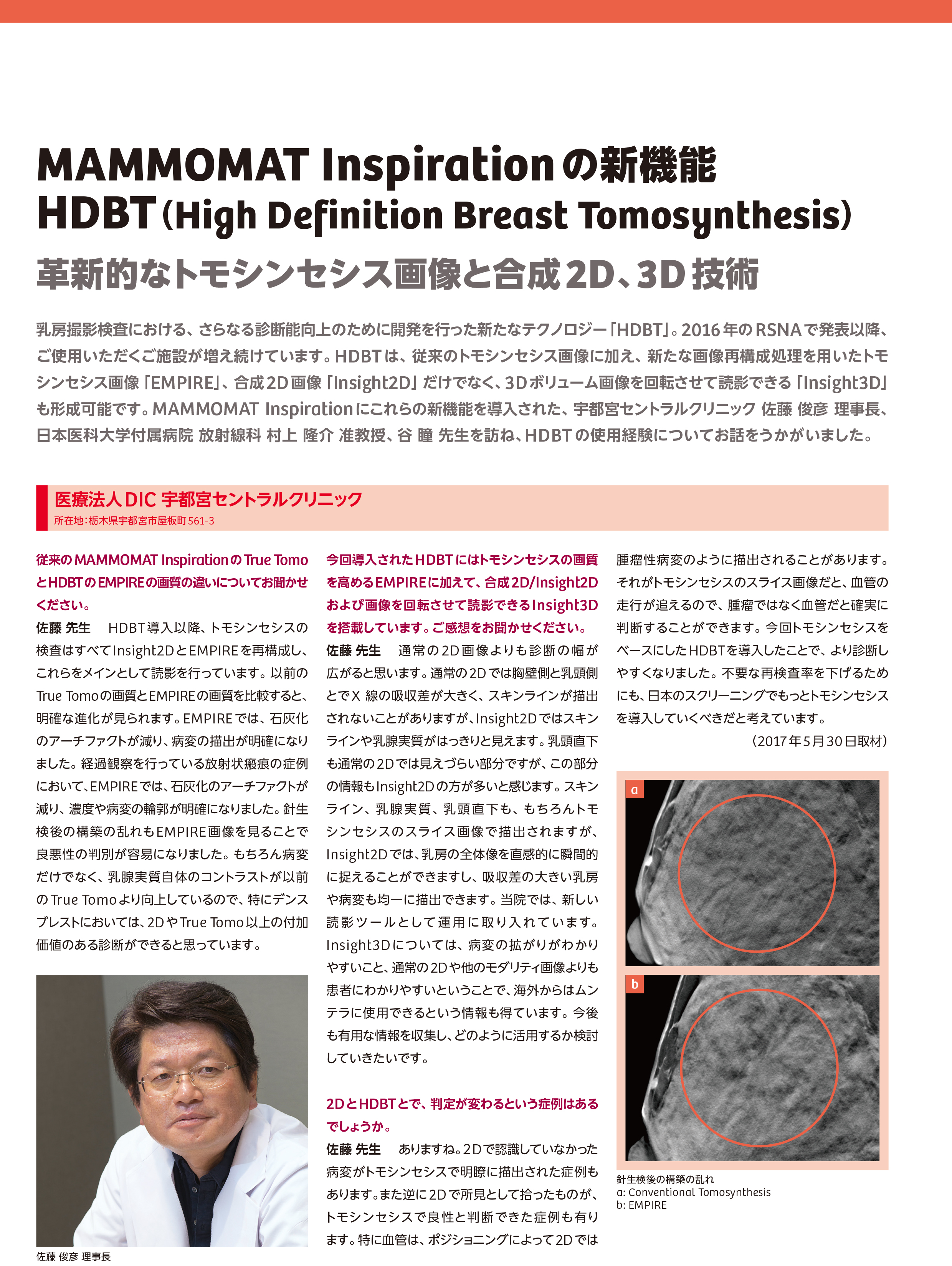 インタビュー】革新的なトモシンセシス画像と合成2D、3D技術