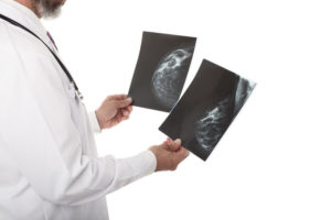 乳腺線維腺腫　画像検査