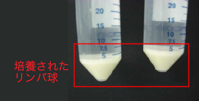 STEP5:リンパ球回収とインターフェロン処理