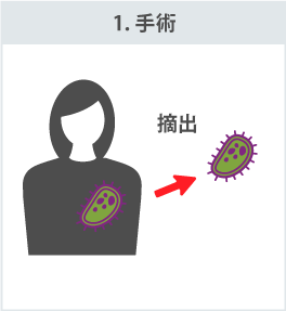 1.手術