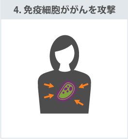 4.免疫細胞ががんを攻撃