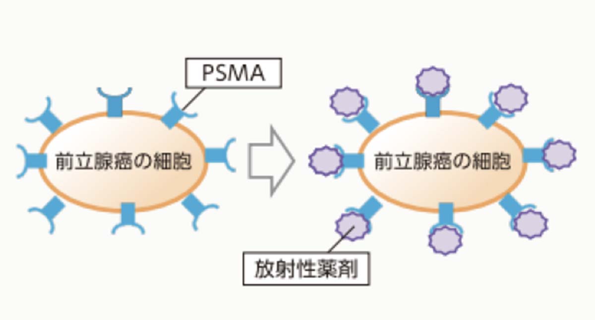 68Ga-PSMA- PET検査について